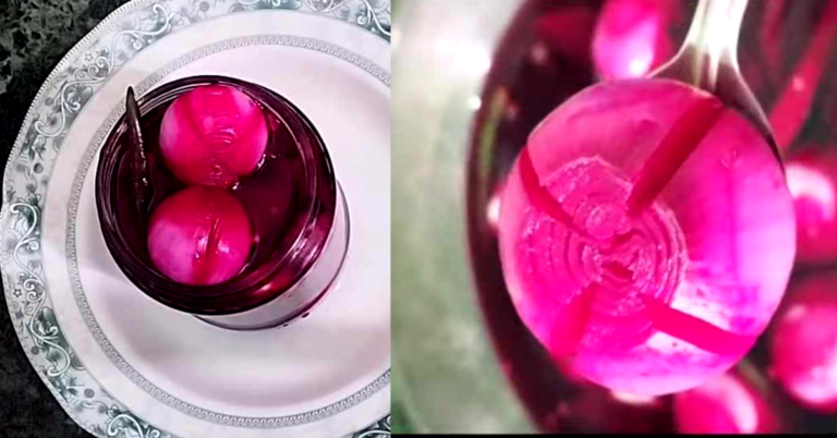 Pickled Vinegar Onion